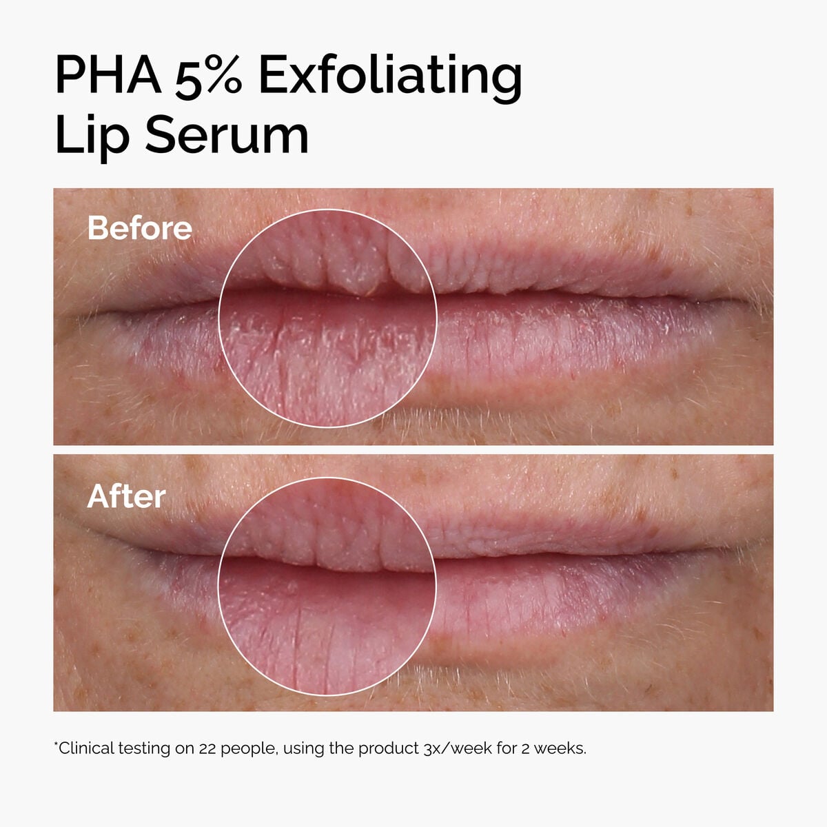 PHA 5% Exfoliating Lip Serum Targeted Serum Care